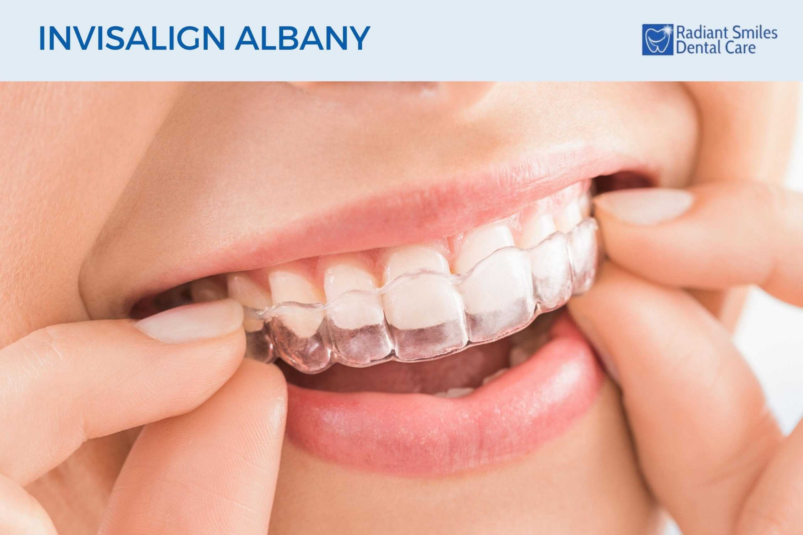 Invisalign Albany - Clear Aligners